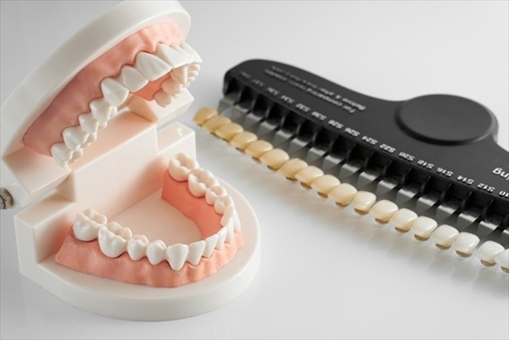 ホワイトニングのシェードガイド